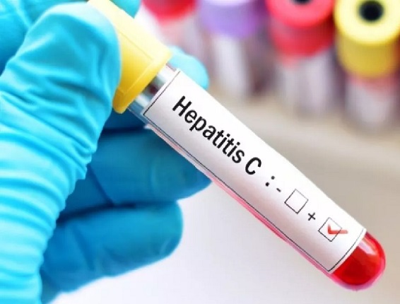 LA ANMAT APROBÓ UNA PRUEBA RÁPIDA PARA DETECTAR LA HEPATITIS C. El diagnóstico puede estar en 20 minutos.